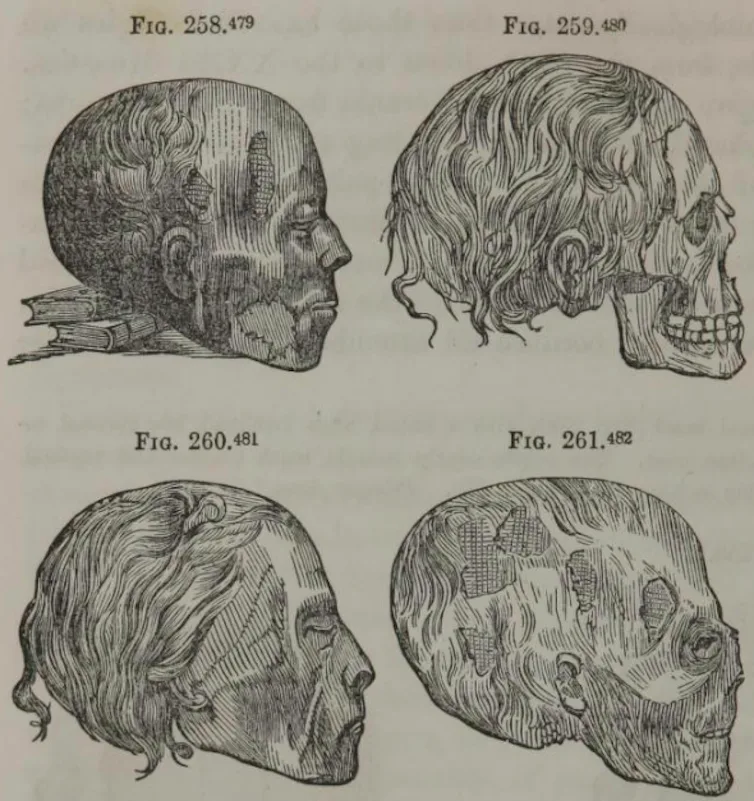 Illustration depicting four different skulls